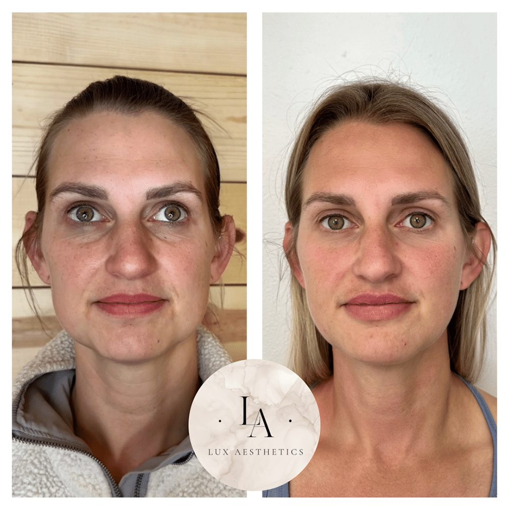 beforeafter1