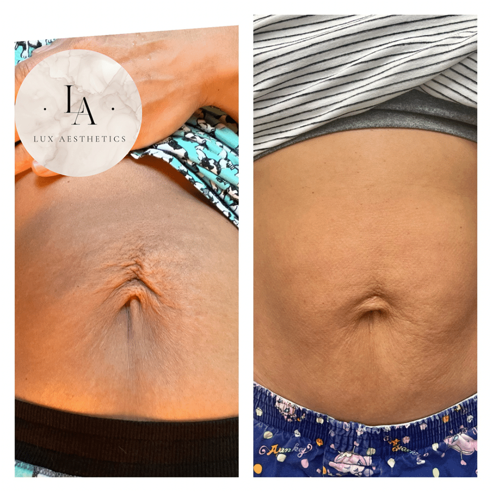 beforeafter2