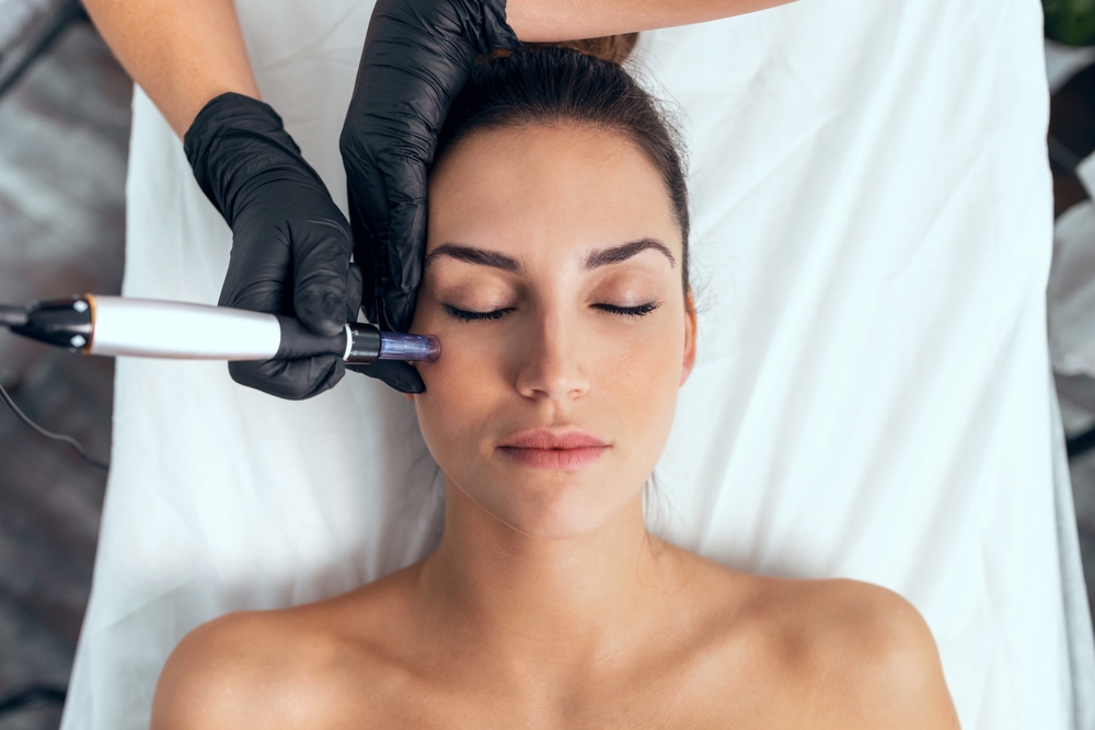 Woman calmly undergoes a microneedling treatment in Seattle.